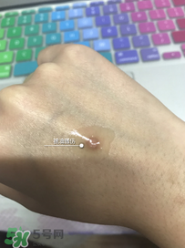 日本msd祛疤膏怎么樣？日本msd祛疤膏有用嗎？