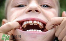 兒童換牙可以吃鈣片嗎?兒童換牙吃什么好？