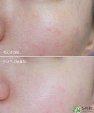 Endocare明星產(chǎn)品推薦 安多可哪些產(chǎn)品好用 Endocare明星產(chǎn)品推薦 安多可哪些產(chǎn)品好用