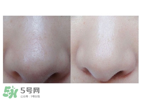 碧柔鼻貼白色和黑色哪個好？碧柔鼻貼黑白區(qū)別