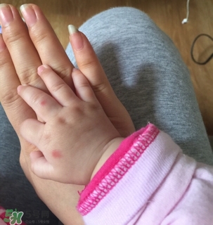 日本叮叮對(duì)寶寶有害嗎？日本叮叮驅(qū)蚊劑孕婦可以用嗎