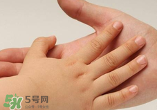 寶寶指甲凹凸不平是什么原因？寶寶指甲凹凸不平正常嗎？