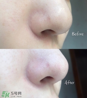 the beautools rocklean毛孔清潔器黑金版和普通版區(qū)別 the beautools rocklean毛孔清潔器黑金版和普通版區(qū)別