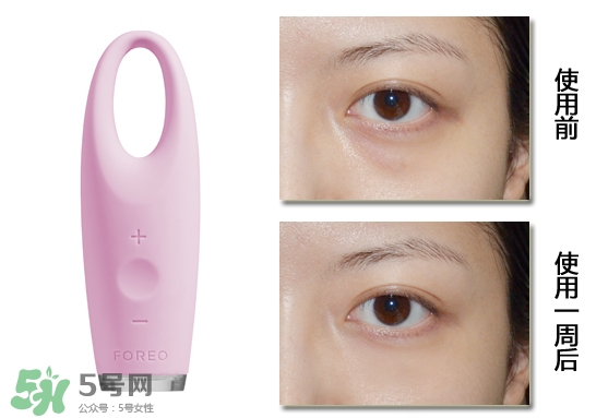 foreo眼部按摩儀好用嗎？foreo iris眼部按摩儀副作用