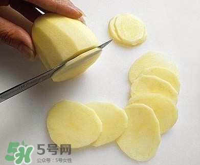 馬鈴薯能去痘印嗎？馬鈴薯可以祛痘?。?></p><p>馬鈴薯含還有豐富的維生素B1、B2、B6、和維生素B6和其他維生素B和大量的高質(zhì)量的纖維素，還含有微量元素、氨基酸、蛋白質(zhì)、脂肪、和高質(zhì)量的營(yíng)養(yǎng)元素，其中的種種，對(duì)于我們來(lái)說(shuō)，要保持皮膚有很好的療效，而且還可以抗衰老、瘦身！</p><p>可以配合其他的療法，一起作用，效果更好，比如外涂維生素E，多吃蔬菜水果，多吃維生素，也可以吃21金維他。使用莓多酚，能修復(fù)皮損，有效提高細(xì)胞活性，促進(jìn)細(xì)胞再生功能，從而修復(fù)缺損的真皮層。</p><h3>馬鈴薯祛痘印的方法</h3><p>1、清潔面部</p><p>2、準(zhǔn)備新鮮馬鈴薯一只，并將馬鈴薯去皮；</p><p>教您如何用馬鈴薯輔助祛痘的方法</p><p>3、將馬鈴薯切成非常薄的片，可以用我們平常削水果皮用的削皮刀，至于能切成多薄，還是要看你自己的技術(shù)水平；</p><p style=