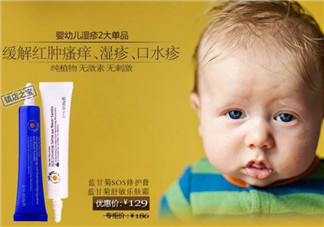 恩姆花園濕疹膏有激素嗎？恩姆花園濕疹膏含不含激素？