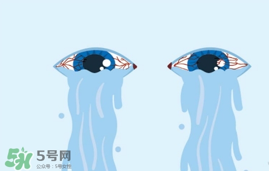 眼藥水可以兩個人用嗎？眼藥水可以共用嗎？