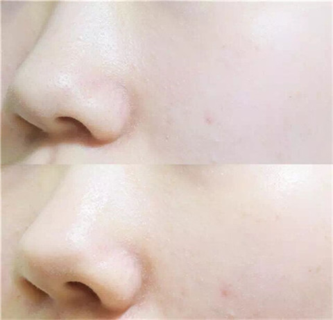 春雨面膜的功效與作用 春雨面膜有什么效果 春雨面膜的功效與作用 春雨面膜有什么效果