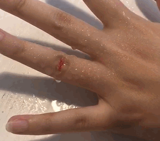 液體創(chuàng)可貼防水嗎？液體創(chuàng)可貼防水嗎透氣嗎？