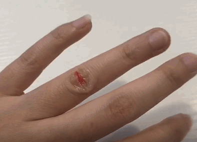 液體創(chuàng)可貼防水嗎？液體創(chuàng)可貼防水嗎透氣嗎？