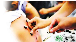 三伏貼要貼幾次？三伏貼要貼多久？