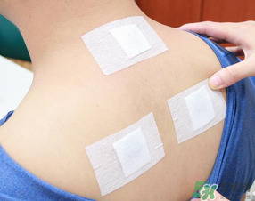 三伏貼貼在什么位置？三伏貼貼哪里？