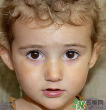 熱性驚厥的臨床表現(xiàn) 如何判斷寶寶是不是熱性驚厥？