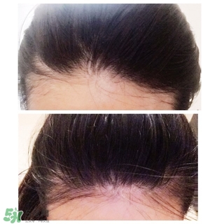 Grow Gorgeous生發(fā)精華有用嗎？Grow Gorgeous用法