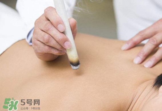 一天中什么時間艾灸好？艾灸什么時間做最好