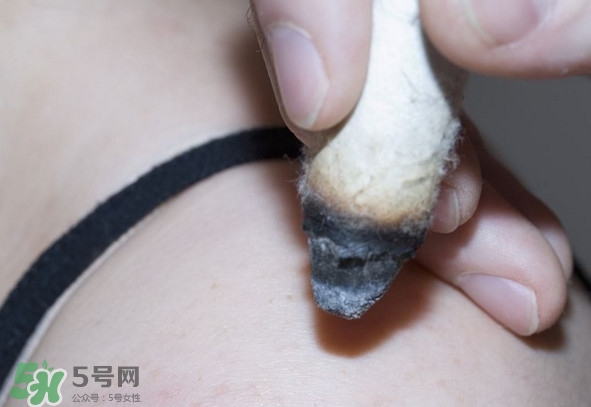 艾灸后為什么會(huì)癢？艾灸后為什么要多喝水