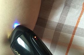 smooth skin脫毛儀怎么用？smoothskin慕金脫毛儀使用方法