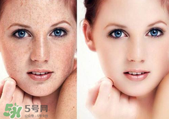 茄子皮敷臉可以祛斑嗎？茄子皮祛斑正確方法