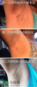 松下es wh93脫毛儀怎么樣？松下es wh93脫毛儀多少錢