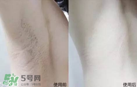 nair脫毛膏評(píng)測？nair脫毛膏保質(zhì)期