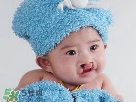 兔唇可以治嗎？兔唇修補術(shù)