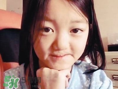 兔唇是什么？兔唇是什么原因造成的？