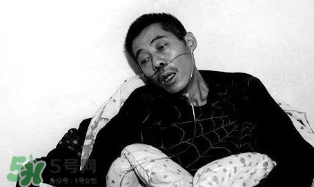 塵肺病吃什么藥能清肺？塵肺病國家有什么政策