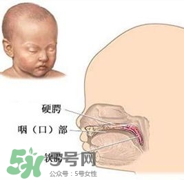 兔唇能檢查出來(lái)嗎？兔唇能完全修復(fù)嗎？