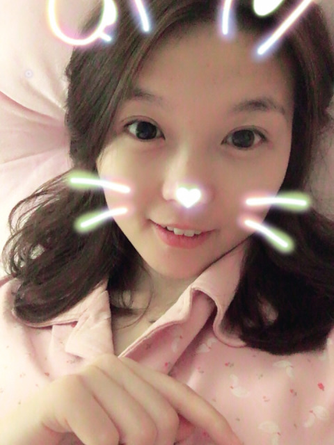 三點(diǎn)定位雙眼皮永久嗎 三點(diǎn)定位雙眼皮恢復(fù)過程圖片 三點(diǎn)定位雙眼皮永久嗎 三點(diǎn)定位雙眼皮恢復(fù)過程圖片