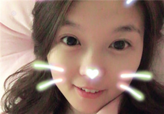 三點定位雙眼皮永久嗎 三點定位雙眼皮恢復過程圖片