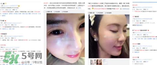 天倍面膜是日本的嗎？日本tenbe天倍面膜騙局