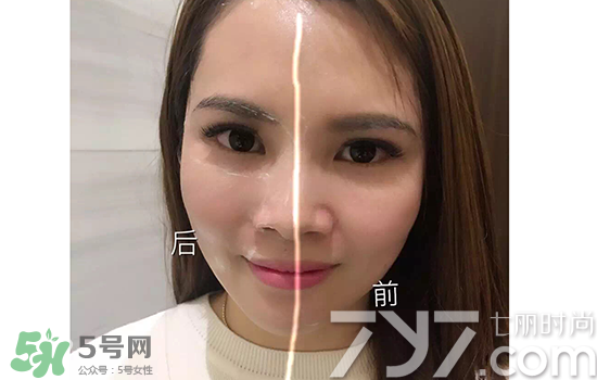 黃金棒有什么用？黃金棒的功效與作用