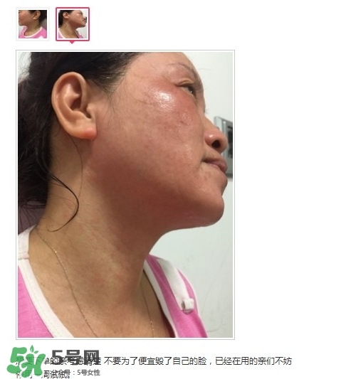 肌膚之食是什么牌子？肌膚之食讓我毀容了