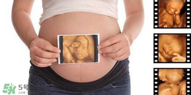 四維彩超有必要做嗎？四維彩超檢查不出什么？