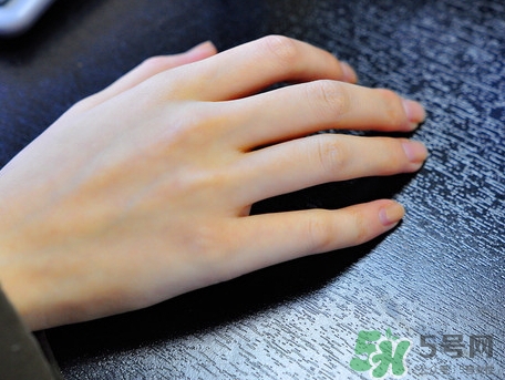 整個(gè)手掌都脫皮是什么原因_手掌脫皮怎么辦 整個(gè)手掌都脫皮是什么原因_手掌脫皮怎么辦