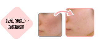 娜芙化妝品怎么樣 娜芙化妝品好用嗎 娜芙化妝品怎么樣 娜芙化妝品好用嗎