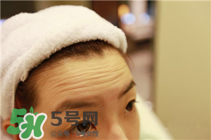 抬頭紋是什么?抬頭紋是怎么產生的?