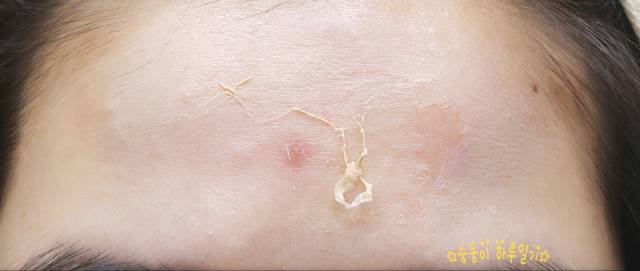 real skin patch怎么樣？real skin是什么牌子