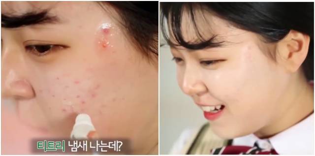 real skin patch怎么樣？real skin是什么牌子