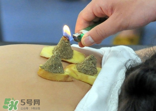 三伏灸有用嗎？2017年三伏艾灸時(shí)間