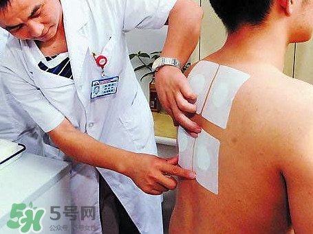 三伏灸可以治療什么??？三伏灸與艾灸有什么區(qū)別