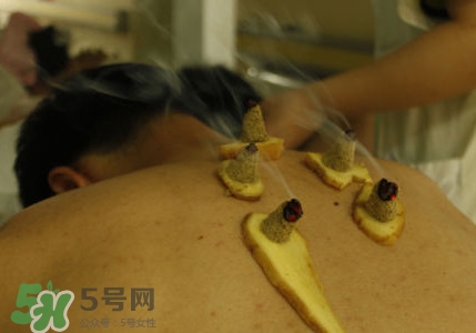 三伏灸有用嗎？2017年三伏艾灸時(shí)間