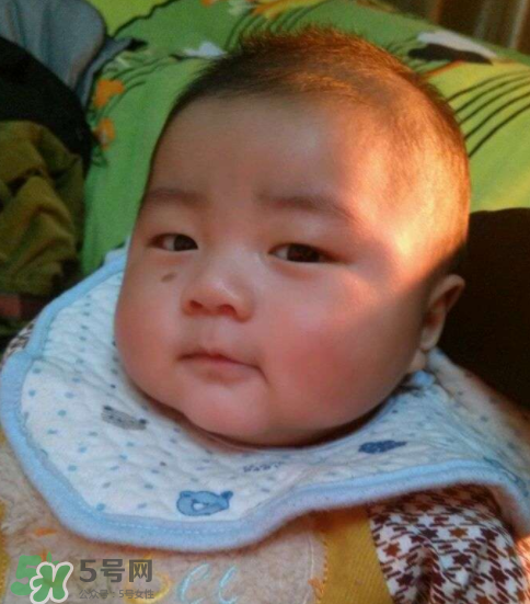 寶寶胎記什么時候去掉？寶寶胎記什么時候去掉最好？