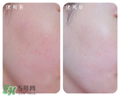 高姿勻凈透亮萃白禮盒多少錢(qián)？高姿勻凈透亮萃白禮盒價(jià)格