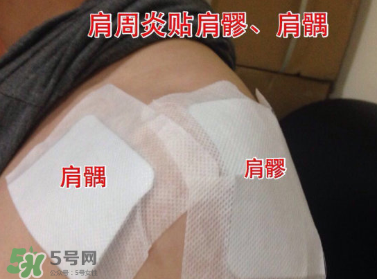 艾灸貼多少錢一盒?？艾灸貼一盒60裝多少錢？