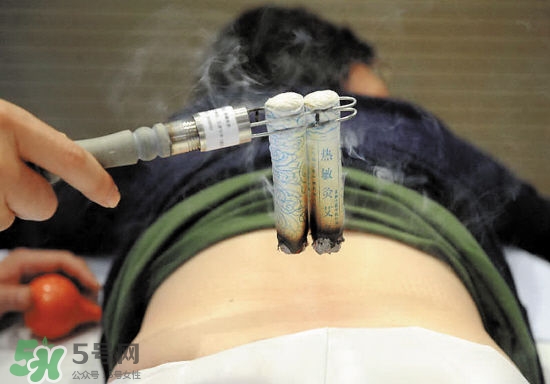 艾灸多少錢一次？艾灸調(diào)理價目表