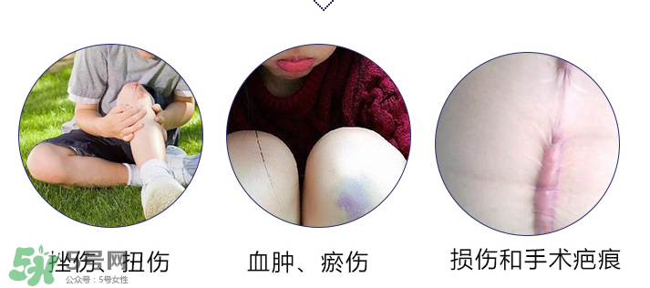 hirudoid除疤膏有效嗎？hirudoid去疤膏效果如何？