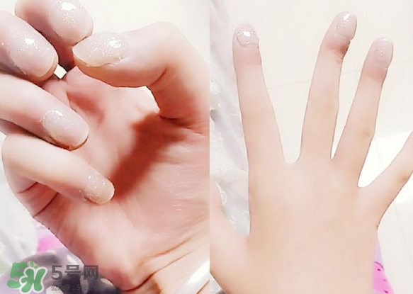 手心出汗怎么治療?手心出汗怎么辦? 手心出汗怎么治療?手心出汗怎么辦?