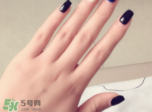 手心出汗怎么治療?手心出汗怎么辦? 手心出汗怎么治療?手心出汗怎么辦?