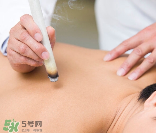 三伏貼和艾灸哪個好？三伏貼和艾灸區(qū)別